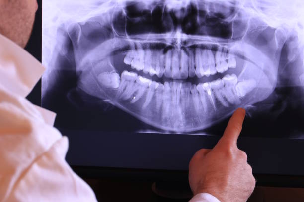Best Emergency Dental Surgery in Mullins, SC