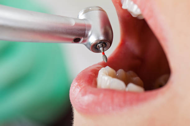 Best Pediatric Emergency Dentist in Mullins, SC